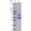 sp-pme c100088 cxcr2 sp1