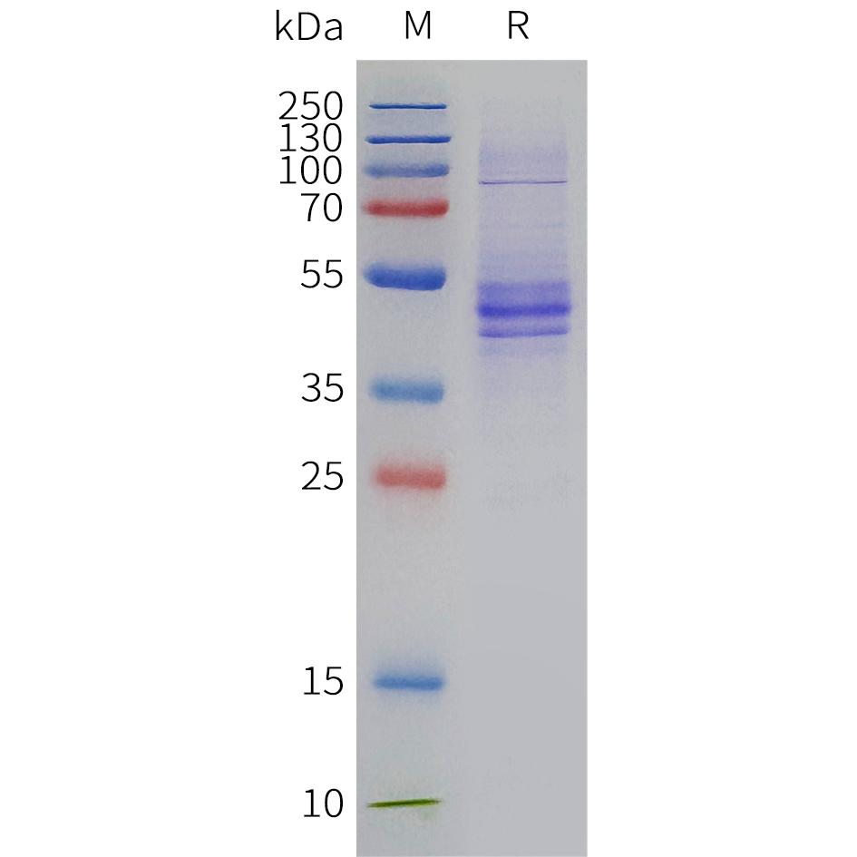 pme-c100113-il12b-sp1.png