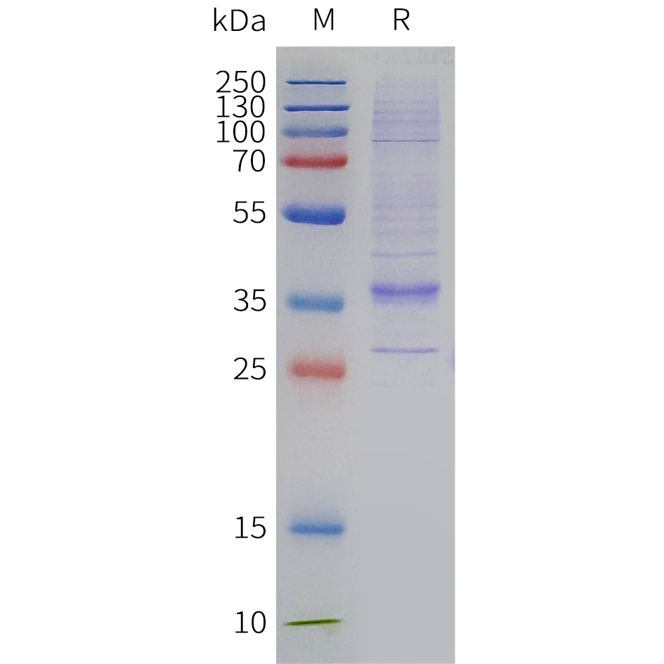pme-c100114-lilrb4-sp1.png