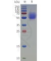 sp-pme c100125 il1rl2 sp1