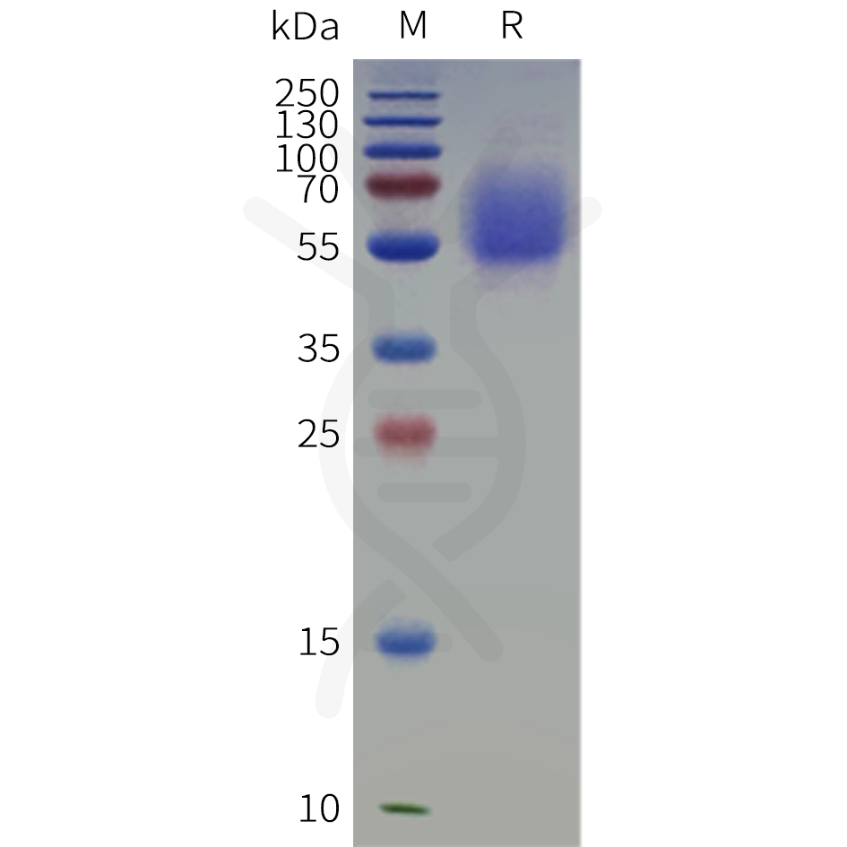 pme-c100125-il1rl2-sp1.png