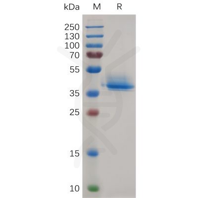sp-pme d100002 anxa2 sp1