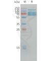 sp-pme d100009 pd l1 sp1