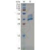 sp-pme m100001 bcma sp1