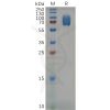 sp-pme m100004 2b4 sp1