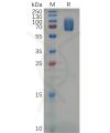 sp-pme m100004 2b4 sp1