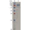sp-pme m100014 cd138 sp1