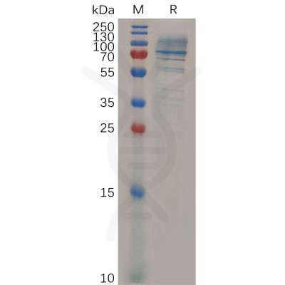 sp-pme m100014 cd138 sp1