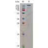 sp-pme m100021 tenm4 sp1