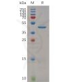 sp-pme m100023 rnase4 sp1