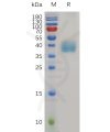 sp-pme m100040 mesothelin sp1