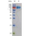 sp-pme m100051 csf1r sp1