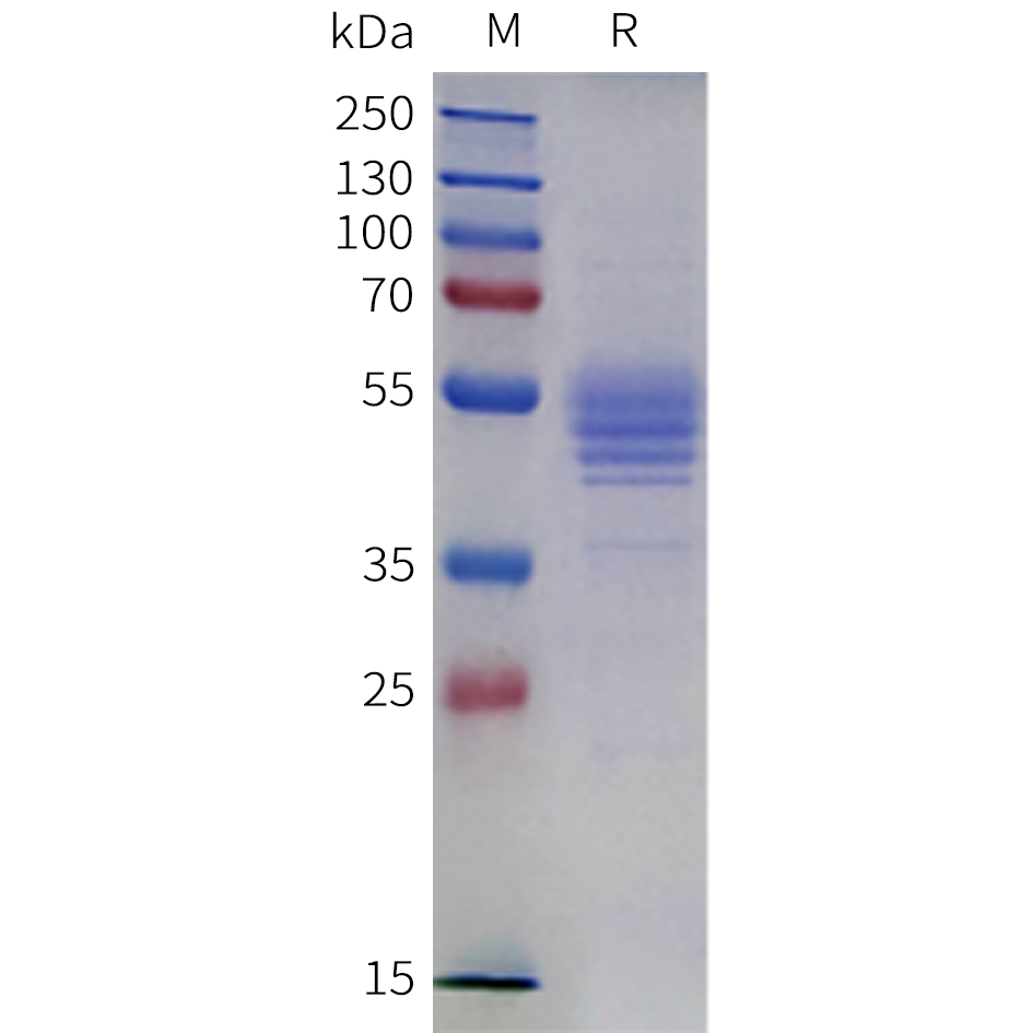 pme-m100140-il12b-sp1.png