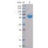 sp-pme100011 4 1bb sp1