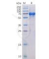 sp-pme100022 ox40 sp1