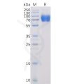 sp-pme100024 slamf1 sp1