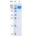sp-pme100034 b7 2 sp1