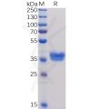 sp-pme100035 bcma sp1