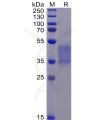 sp-pme100069 fcgr3a sp1