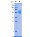 sp-pme100079 nkg2d sp1