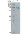 sp-pme100082 tnfrsf1b sp1