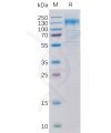 sp-pme100095 her2 sp1