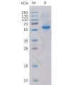 sp-pme100097 ror2 sp1