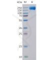 sp-pme100099 egfr sp1