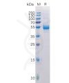 sp-pme100100 tnfsf11 sp1