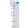 sp-pme100104 vegfr2 sp1