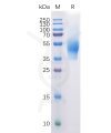 sp-pme100108 cd44 sp1