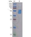 sp-pme100112 ccr4 sp1