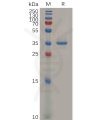 sp-pme100113 gpc3 sp1