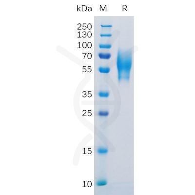 sp-pme100123 5t4 sp1