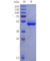 sp-pme100125 acpp sp1