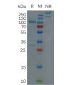 sp-pme100128 adfam9 sp1
