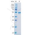 sp-pme100152 ca9 sp1