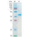 sp-pme100159 ccl20 sp1