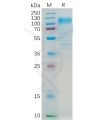 sp-pme100187 cd36 sp1