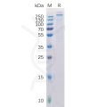sp-pme100217 cspg4 sp1