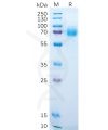 sp-pme100230 dkk1 sp1