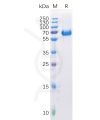 sp-pme100238 epha2 sp1