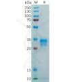 sp-pme100249 folr1 sp1