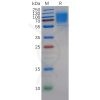 sp-pme100262 gucy2c sp1