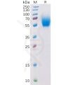 sp-pme100291 il13ra1 sp1