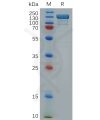 sp-pme100311 itgb1 sp1