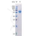 sp-pme100399 ror1 sp1