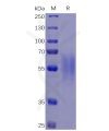 sp-pme100468 il17ra sp1