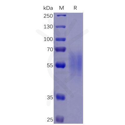 sp-pme100468 il17ra sp1