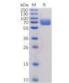 sp-pme100473 b7 1 sp1
